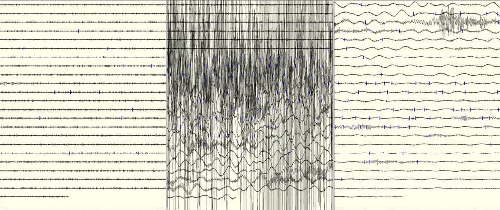 O înregistrare seismografică, cu linii care ilustrează undele seismice. (Foto de arhivă: uair01 / BY 2.0, Openverse)
